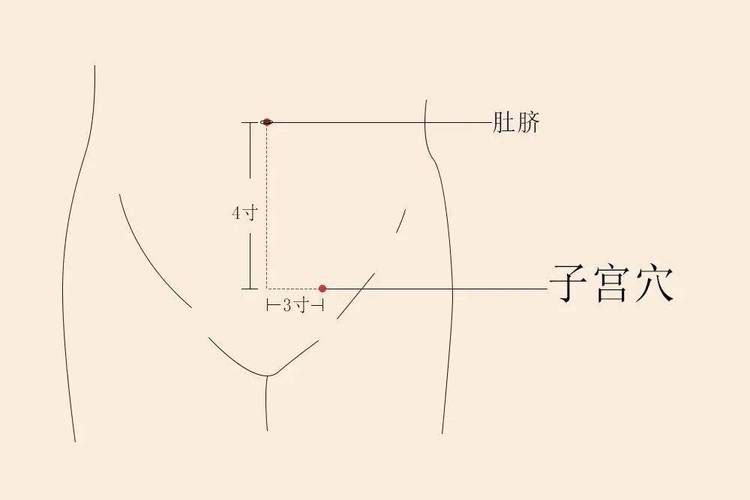 宫颈囊肿艾灸哪些穴位