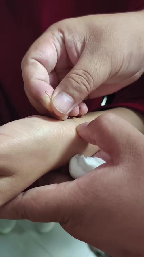 小儿急救手指放血穴位