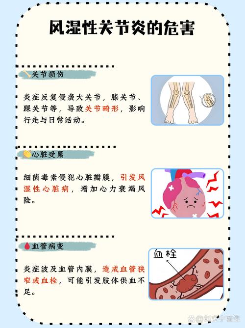 关节痛是风湿还是类风湿