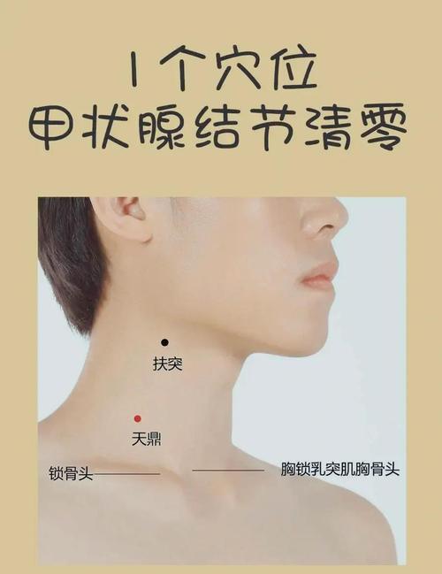 甲状腺结节与中医穴位