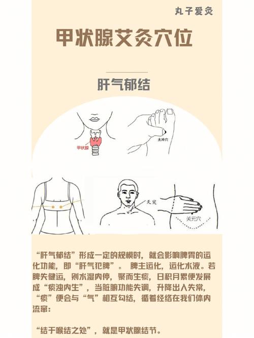 甲状腺结节与中医穴位