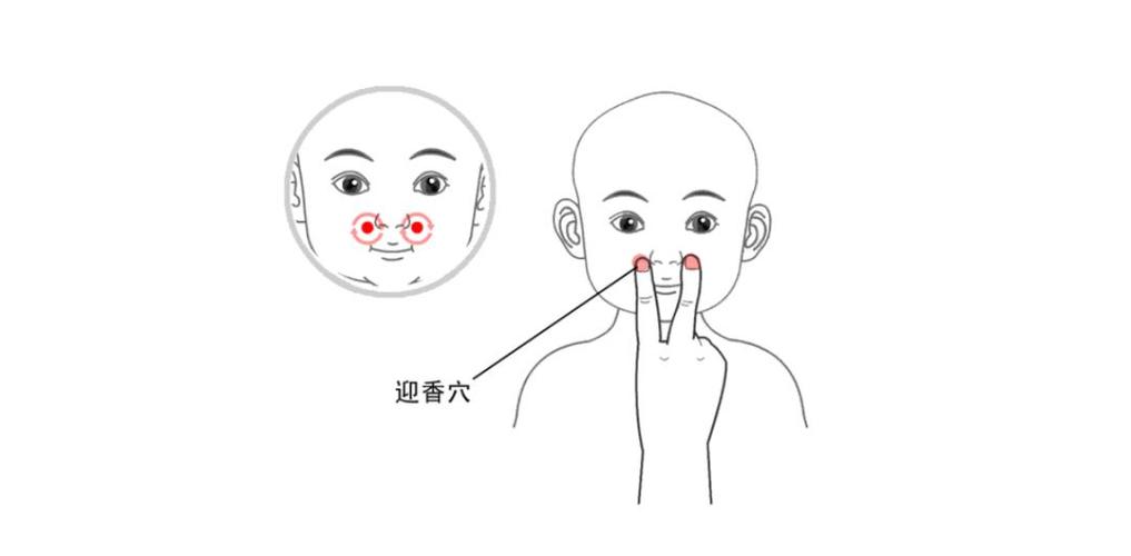 小儿鼻炎穴位治疗方法