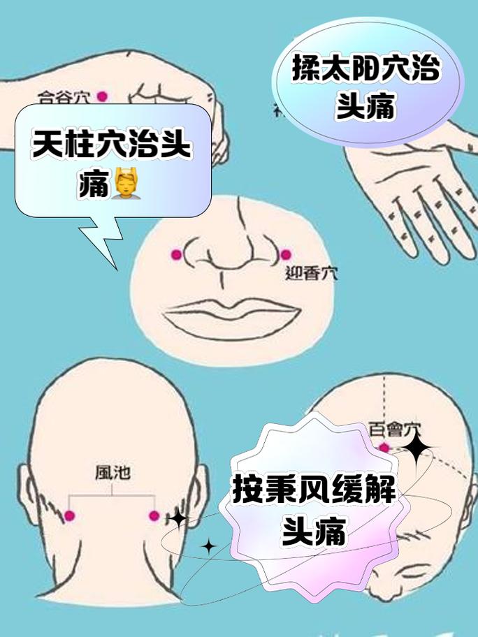 什么穴位缓解神经头痛