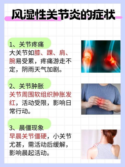 风湿因子多高是风湿病啊