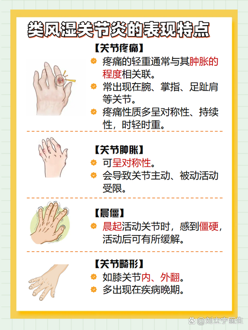 风湿类风湿该怎么治疗好