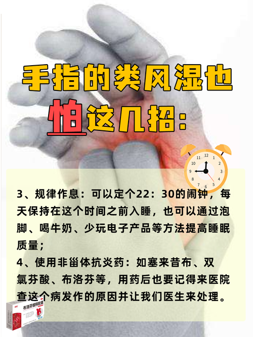 风湿类风湿该怎么治疗好