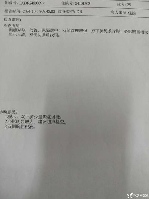 脑梗脑出血心梗心衰病例