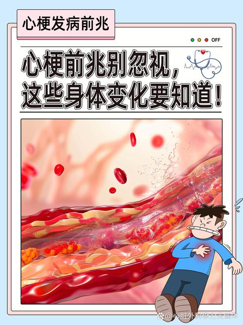 心梗脑梗前期症状有哪些