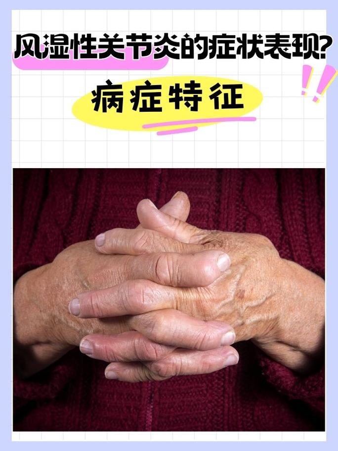 风湿和类风湿的临床表现