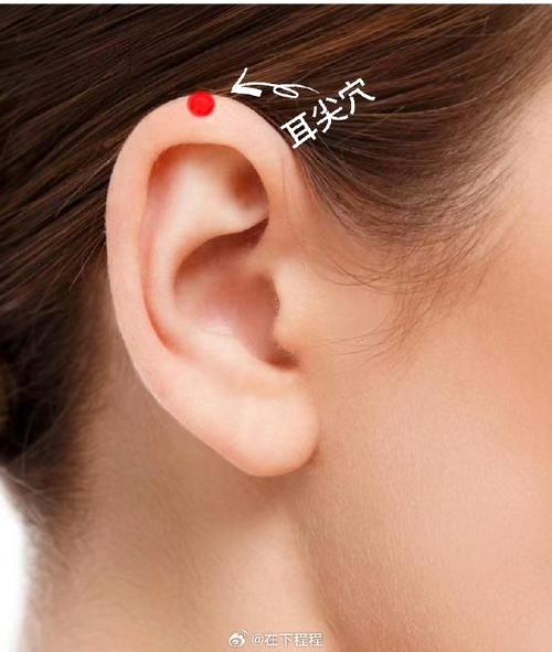 耳边淋巴肿大针灸穴位