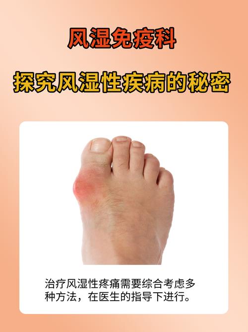 风湿病属于肾病风湿科吗