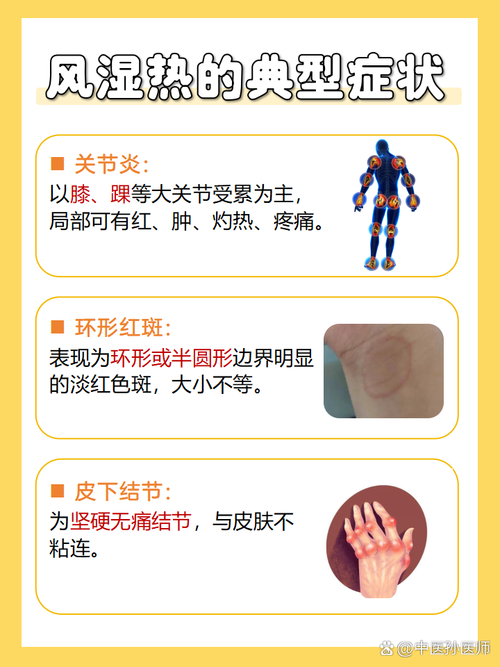 风湿热就是游走性风湿吗