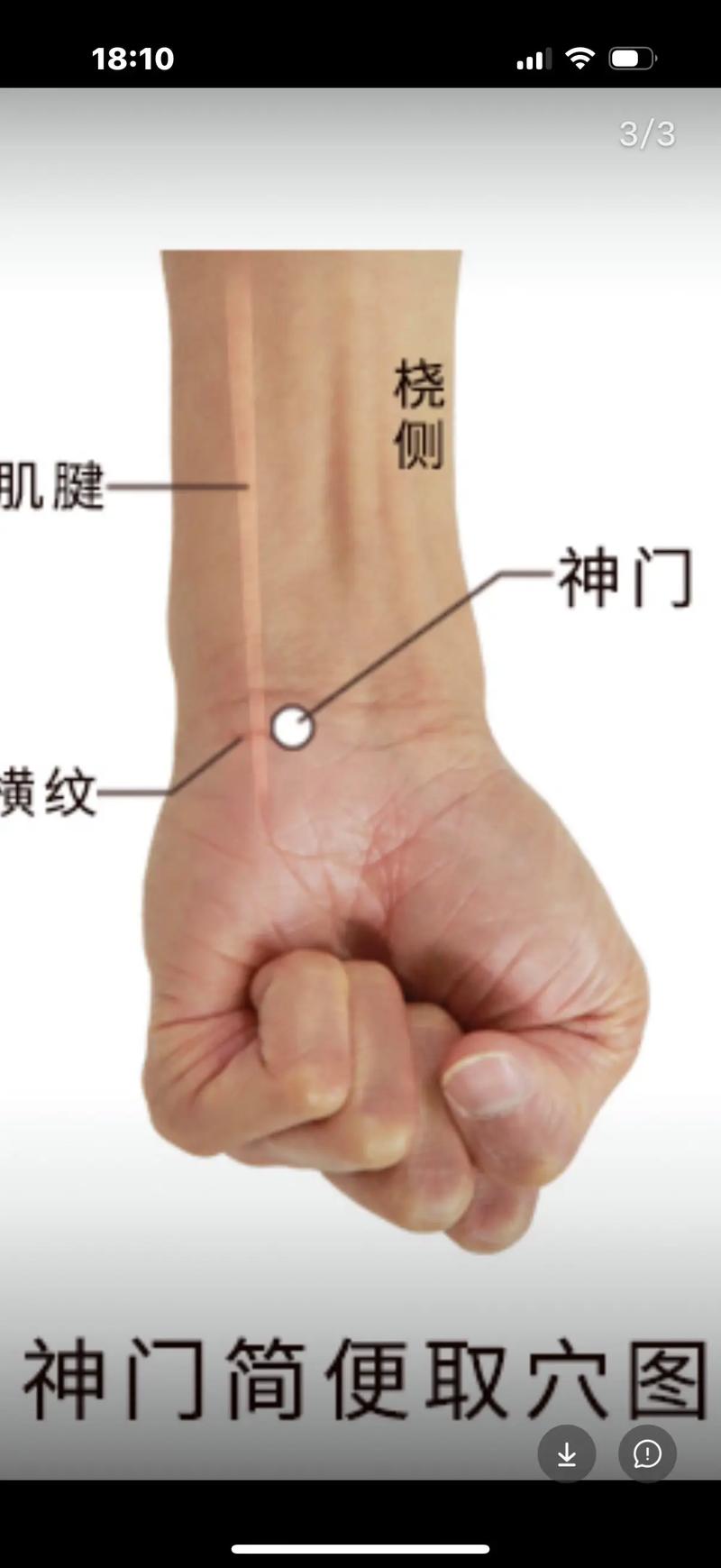 抑郁焦虑中医穴位治疗