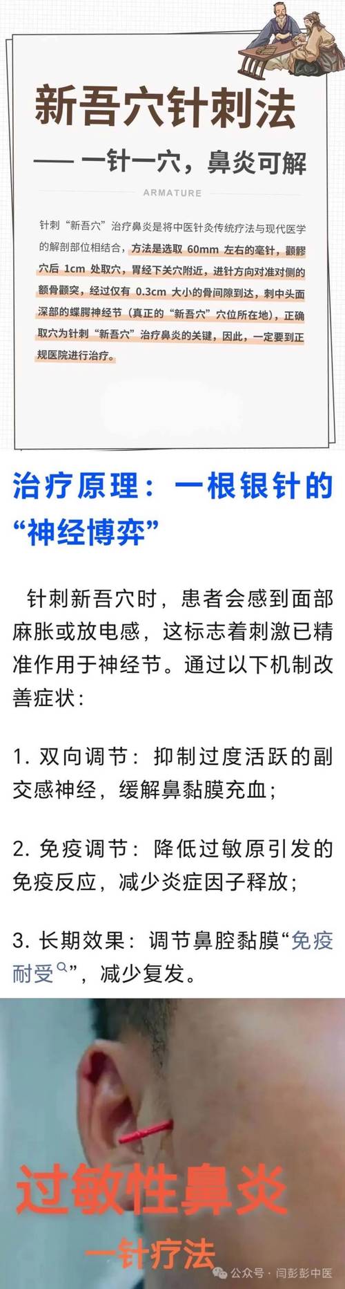 针灸哪些穴位治疗鼻炎