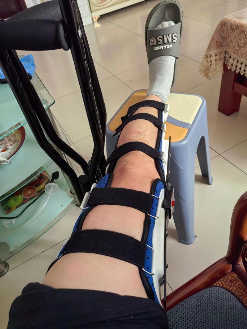 脑梗 恢复 剧烈 腿疼