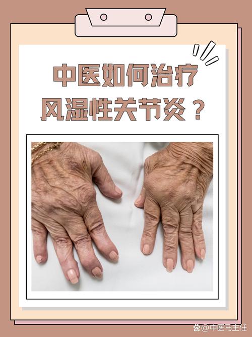 风湿类风湿下午就不疼吗