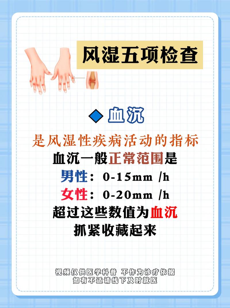 检查风湿类风湿要空腹吗