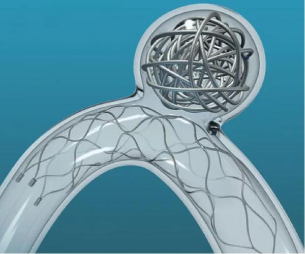 脑梗后心梗可以做支架吗