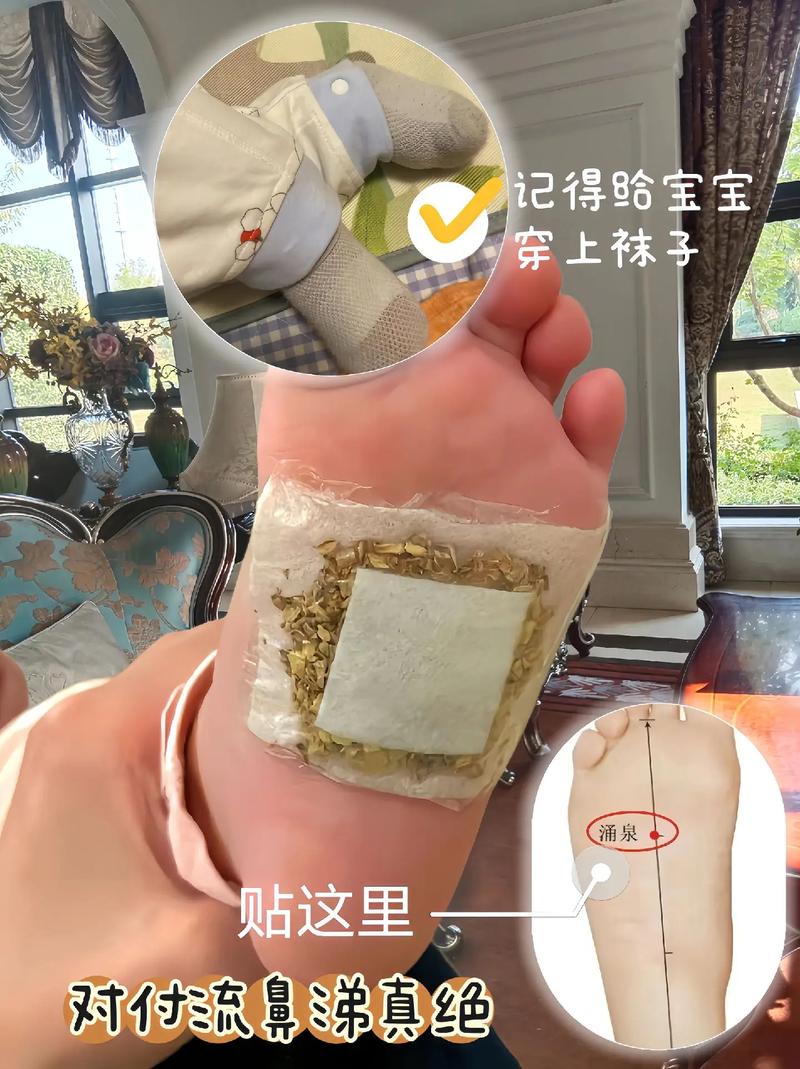 中药穴位贴 宝宝脚底