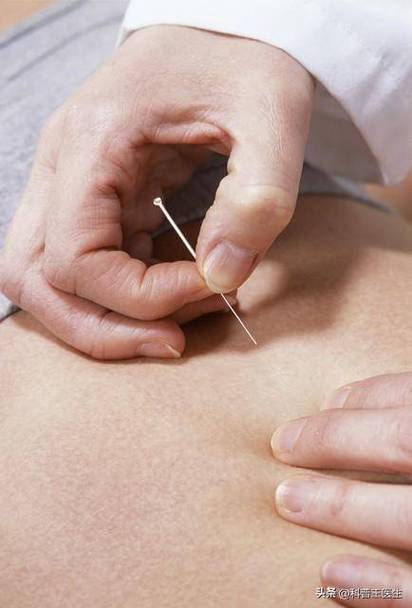 中华医药艾灸-脑梗