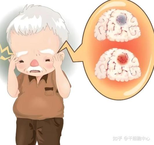 谷维素 脑梗 睡眠不好