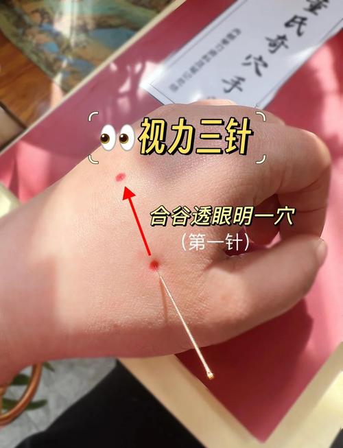 儿童散光按摩哪些穴位