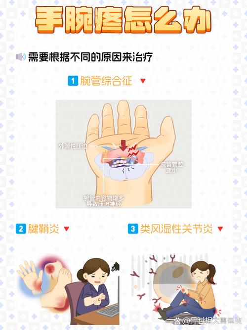 手腕疼是风湿还是类风湿