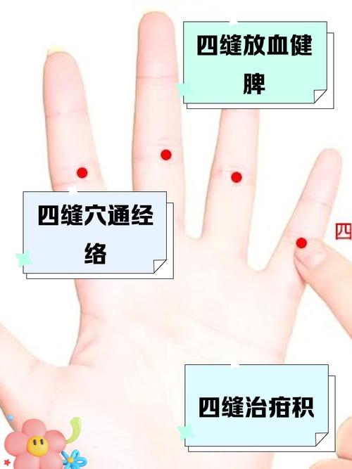 刺激穴位治疗小儿疳积