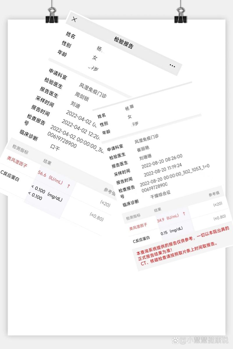 查风湿因子正常是风湿吗