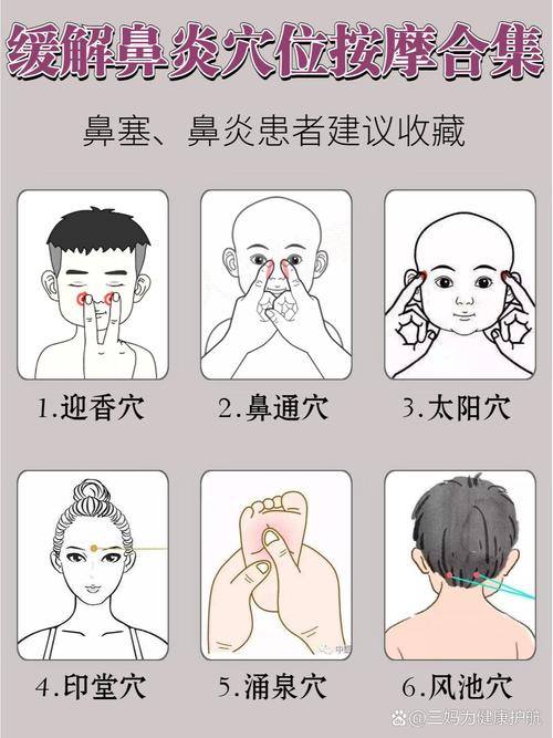 鼻塞 流涕的穴位治疗