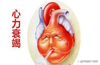 狼疮脑梗心衰35000