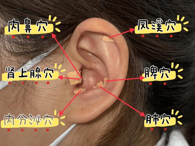 椎间盘突出穴位图耳朵