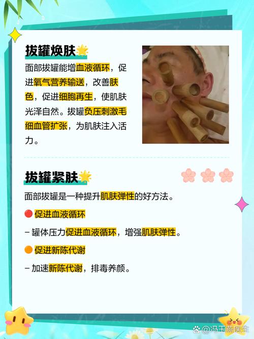 脸部痤疮在哪穴位放血