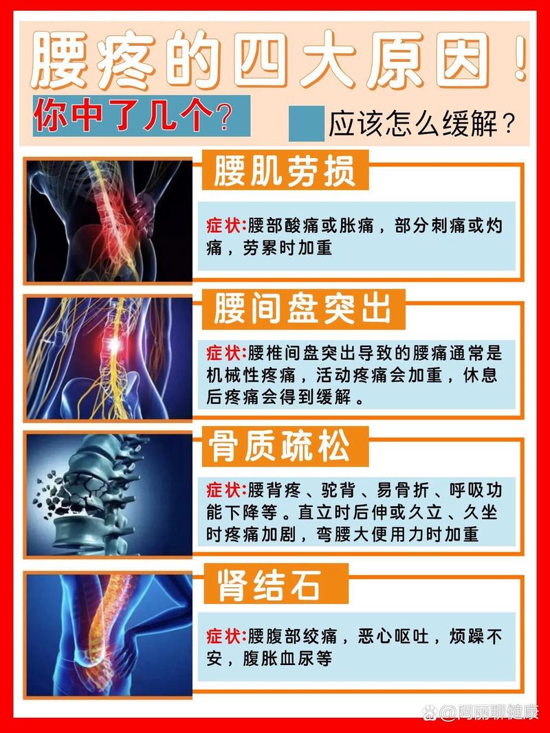 风湿腰痛腿痛是什么风湿