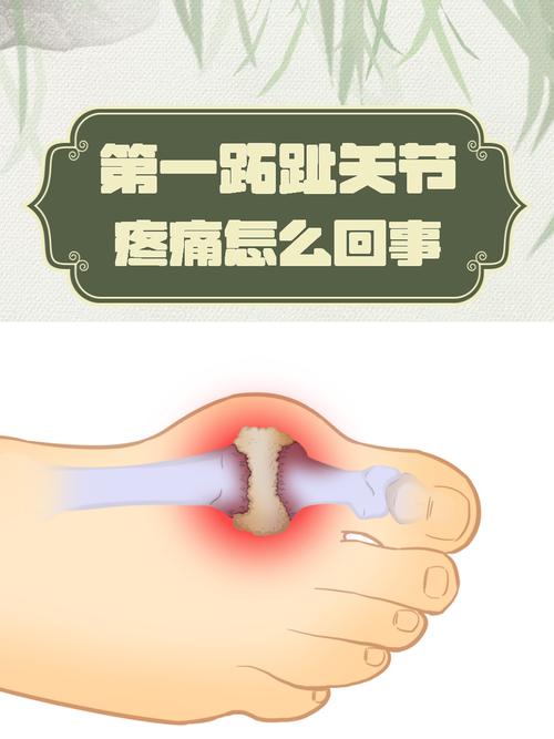 脚趾疼但不是风湿类风湿