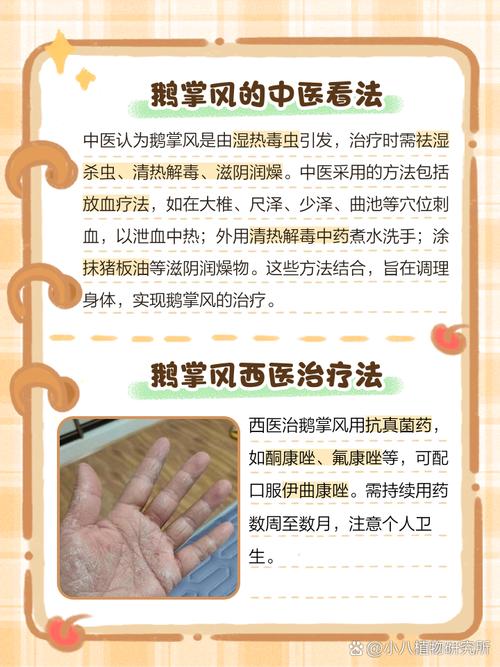 手脚风湿类风湿怎么治疗