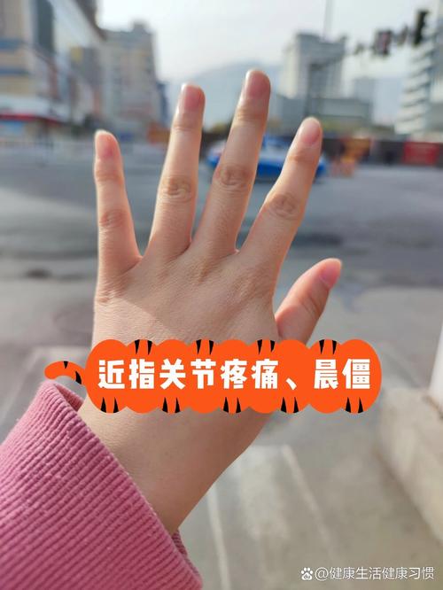 查风湿类风湿需要空腹吗