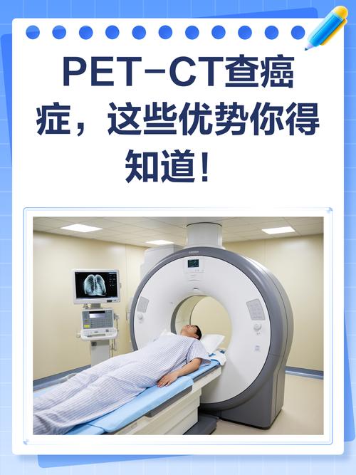 PETCT能否查出脑梗
