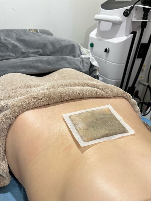 脑梗 偏瘫 中药 热敷