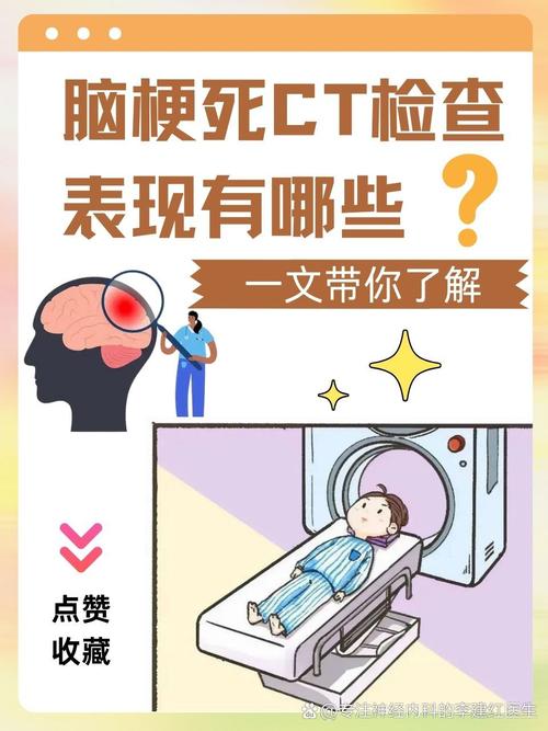 脑ct没事能排除脑梗吗