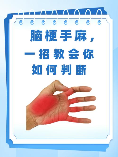 手指麻木会引起脑脑梗吗