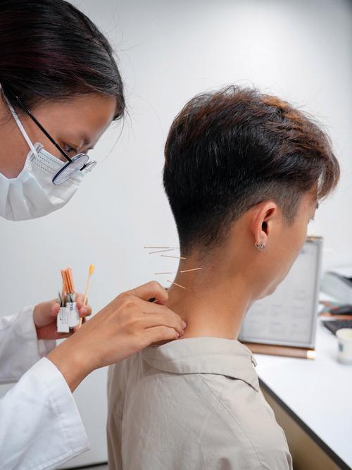 颈椎强直针灸什么穴位