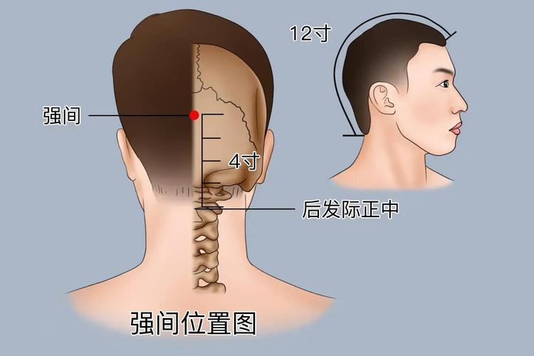 颈椎强直针灸什么穴位