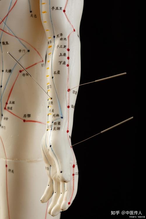 手臂痉挛针灸什么穴位