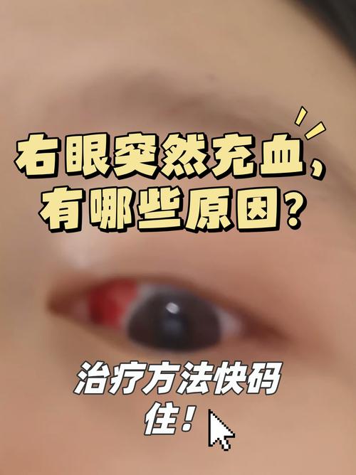警惕 脑梗 眼睛 黑影
