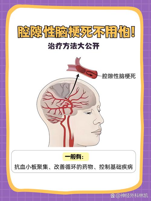 缺血性脑梗和腔隙性脑梗