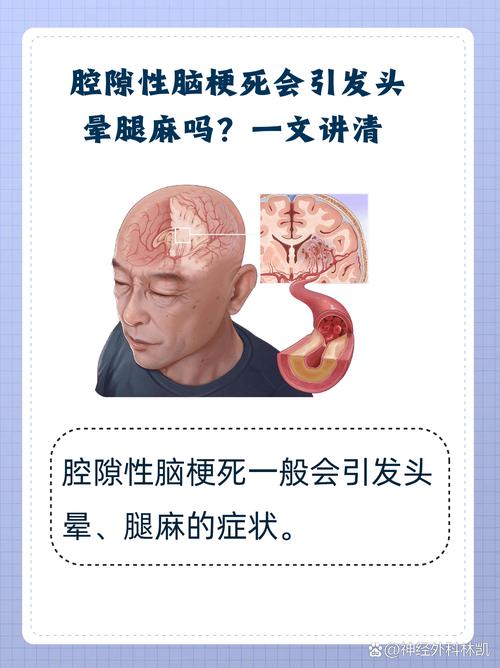 缺血性脑梗和腔隙性脑梗