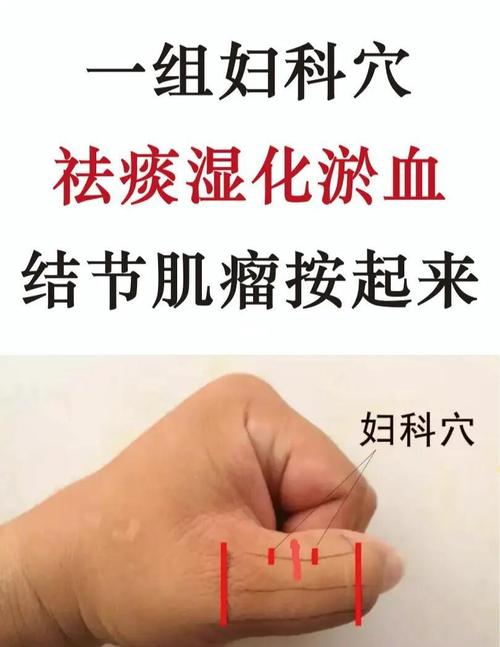 子宫肌瘤怎么按摩穴位