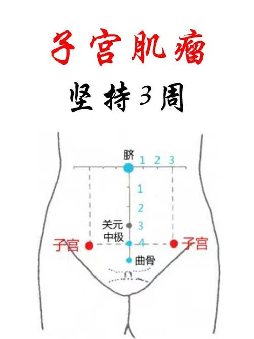 子宫肌瘤怎么按摩穴位