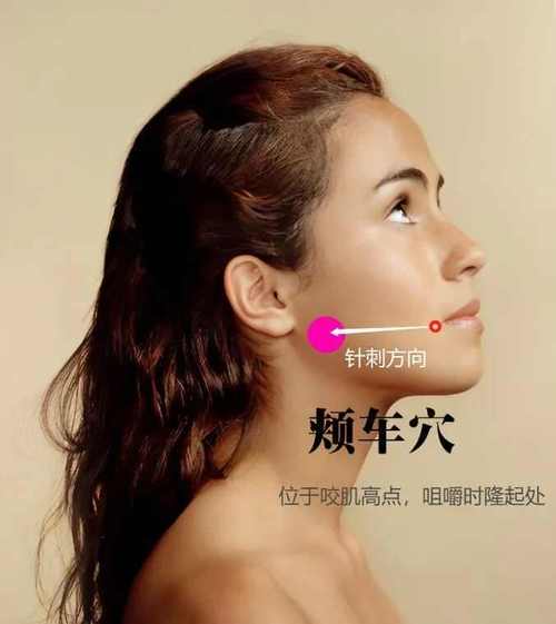 左边面瘫针灸哪些穴位